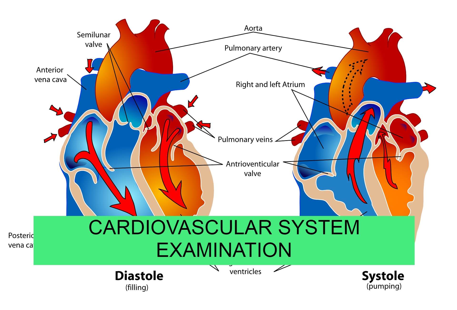 Cardiovascular system examnination