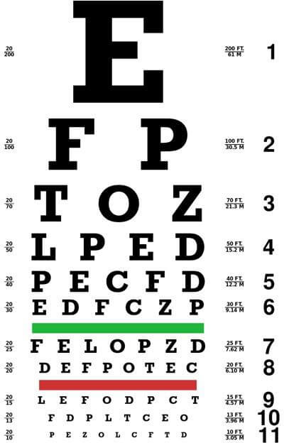 Eye Examination Notes for Medical Students