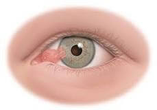 Eye Examination Notes for Medical Students